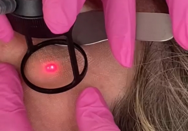 Hybrid CO2 laser