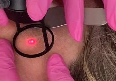 Hybrid CO2 laser